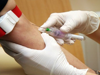 Alternative Treatment for Shingles